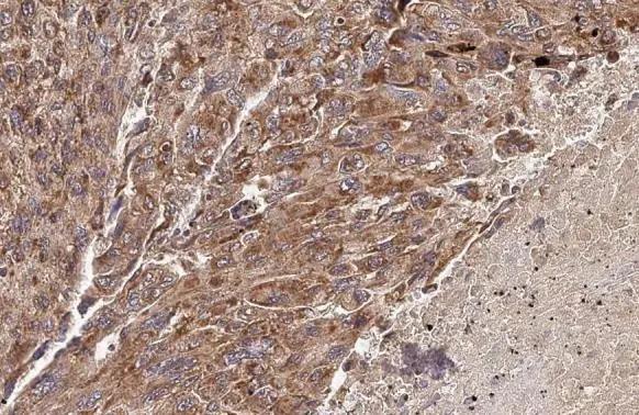 PELO Antibody (HL2345)