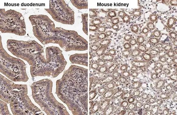 PELO Antibody (HL2345)
