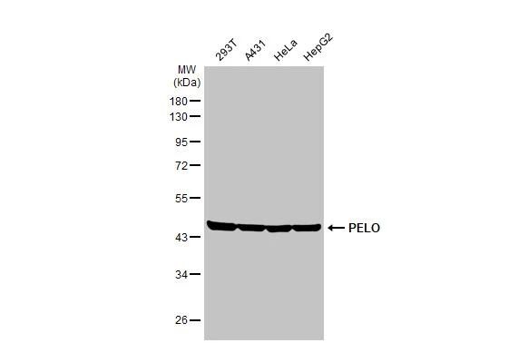 PELO Antibody (HL2345)
