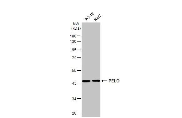 PELO Antibody (HL2345)