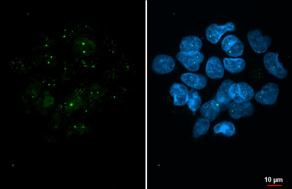Coilin Antibody (HL2384)