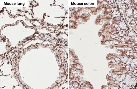 TET3 Antibody (HL2463)