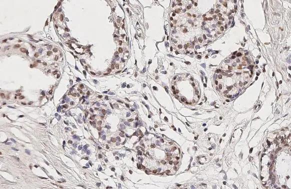 TET3 Antibody (HL2463)