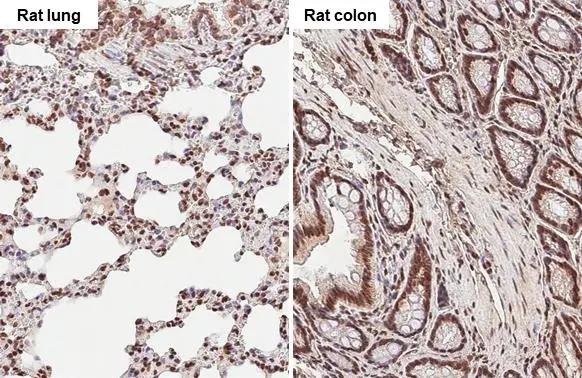 TET3 Antibody (HL2463)