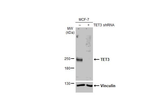 TET3 Antibody (HL2463)