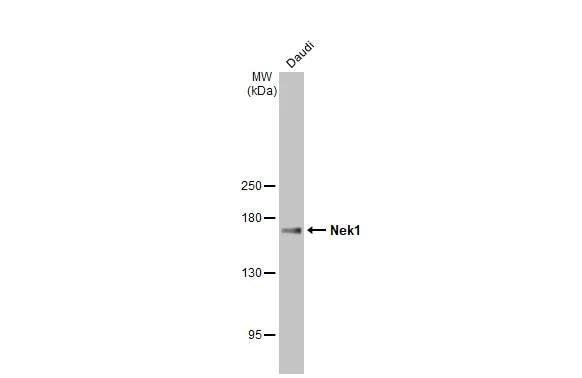 NEK1 Antibody (HL2488)