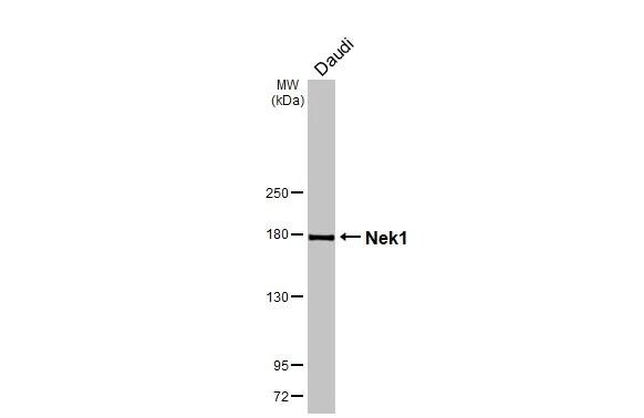 NEK1 Antibody (HL2489)