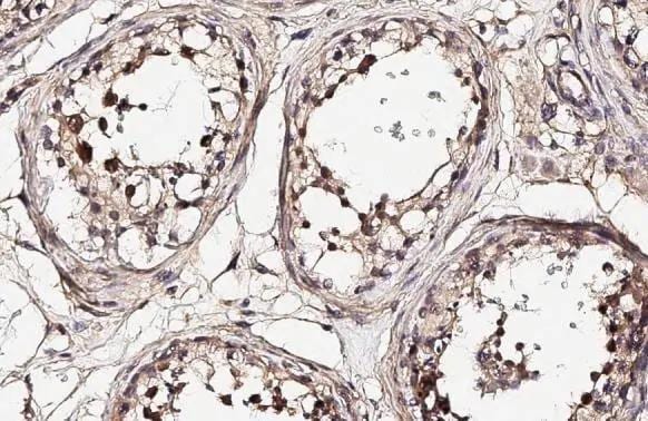 NEK2 Antibody (HL2511)