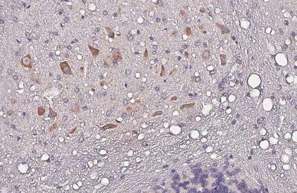Nucleobindin 1 Antibody (HL2532)
