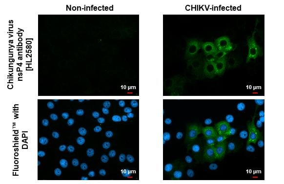 Chikungunya Virus nsp4 Antibody (HL2580)