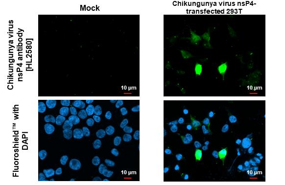 Chikungunya Virus nsp4 Antibody (HL2580)