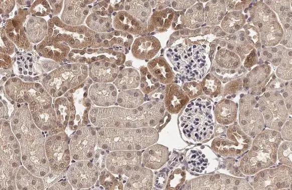 ADAMTSL2 Antibody (HL2616)