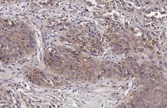 ADAMTSL2 Antibody (HL2616)