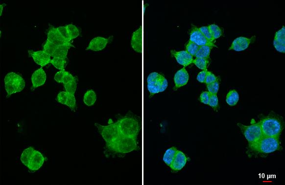 XPR1 Antibody (HL2631)