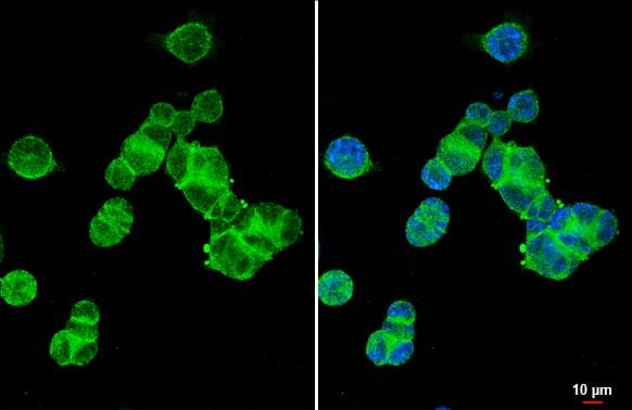 XPR1 Antibody (HL2632)