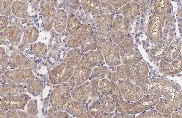 XPR1 Antibody (HL2632)