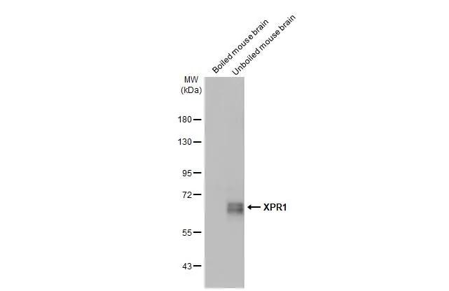 XPR1 Antibody (HL2632)