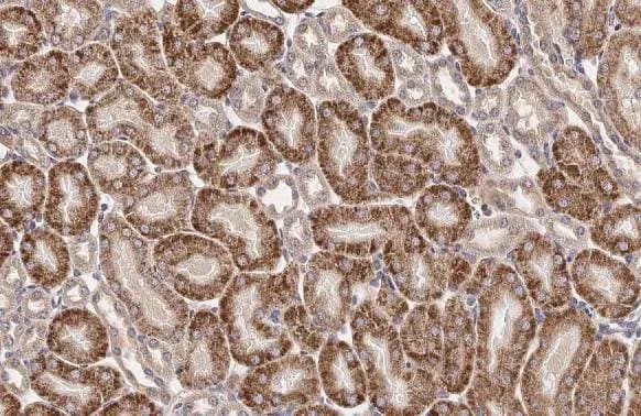 GnRHR Antibody (HL2638)