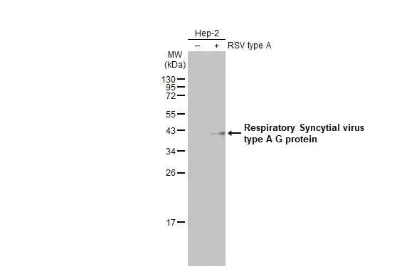 Respiratory Syncytial Virus Subgroup A G Glycoprotein Antibody (HL2643)