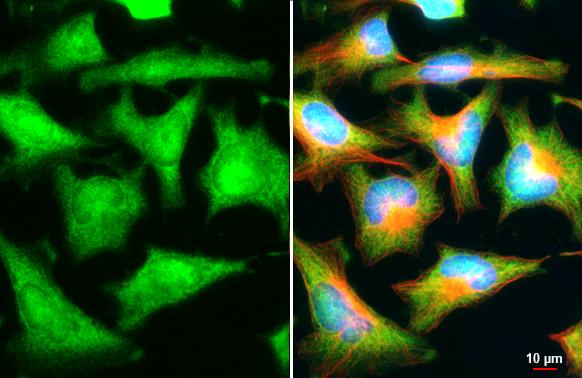 PSAT1 Antibody (HL2663)