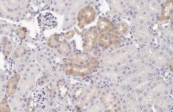 PSAT1 Antibody (HL2663)