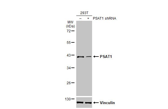 PSAT1 Antibody (HL2663)