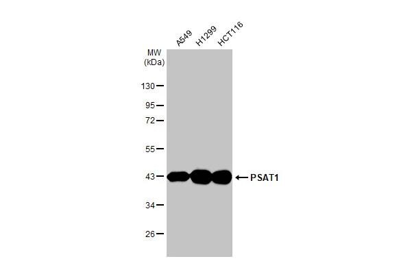 PSAT1 Antibody (HL2663)