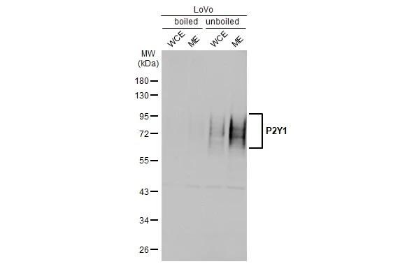 P2Y1/P2RY1 Antibody (HL2702)