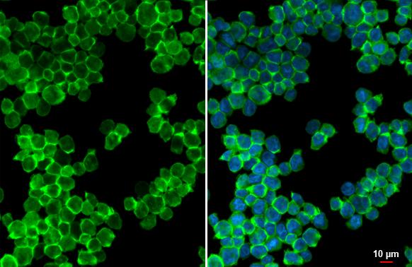 P2Y2 Antibody (HL2704)
