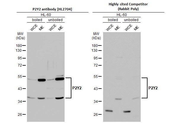 P2Y2 Antibody (HL2704)