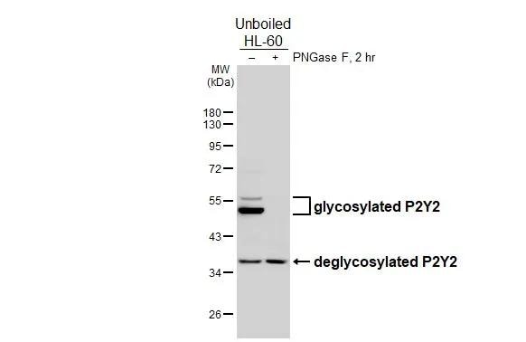 P2Y2 Antibody (HL2704)