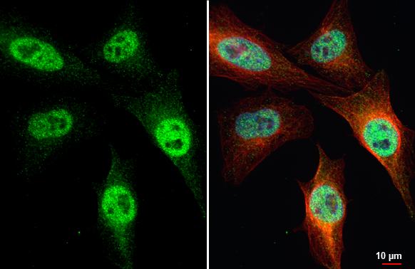 SETD1A Antibody (HL2705)