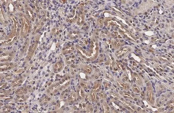 BCKDK Antibody (HL2710)