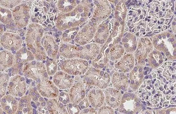 MLYCD Antibody (HL2738)