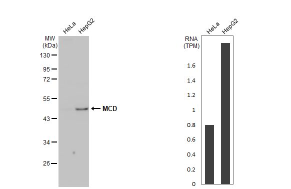 MLYCD Antibody (HL2738)