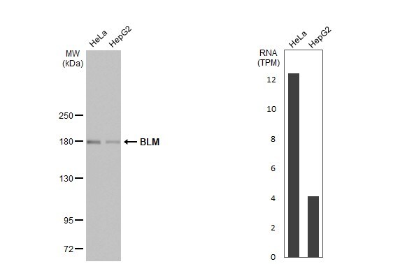 Blooms Syndrome Protein Blm Antibody (HL2771)