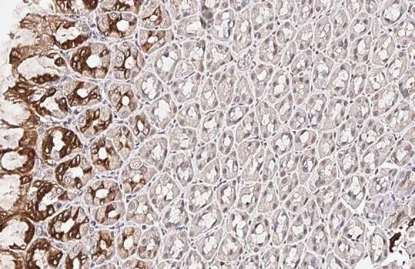 SCAP Antibody (HL2796)