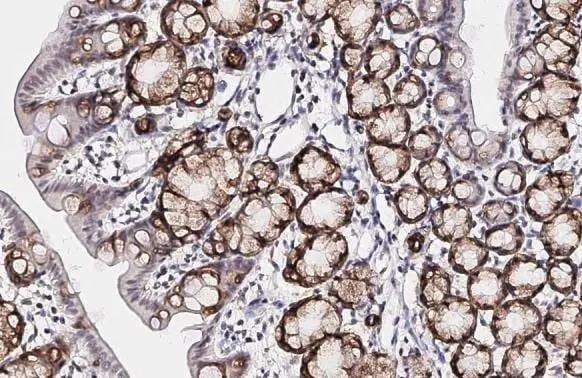 SCAP Antibody (HL2796)