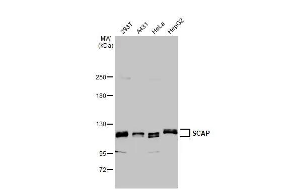 SCAP Antibody (HL2796)