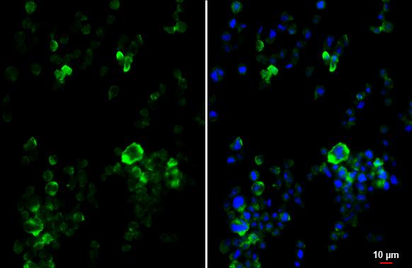 P2Y2 Antibody (HL2801)