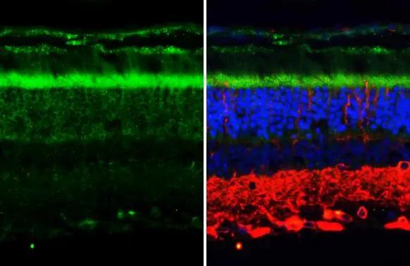P2Y2 Antibody (HL2801)