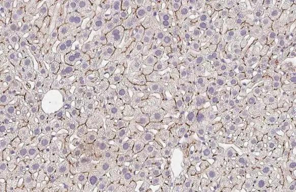ABCB11 Antibody (HL2803)