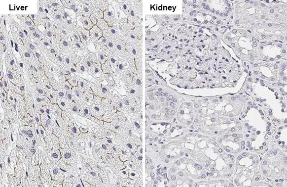 ABCB11 Antibody (HL2803)