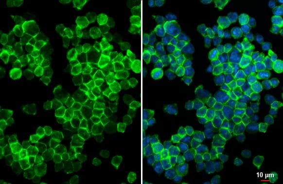P2Y12/P2RY12 Antibody (HL2829)