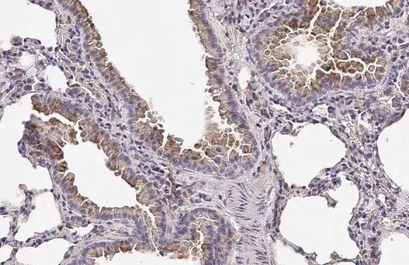EDNRB/Endothelin R Type B Antibody (HL2832)