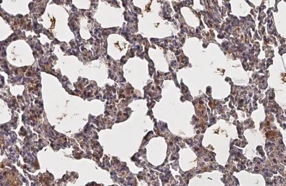 EDNRB/Endothelin R Type B Antibody (HL2832)