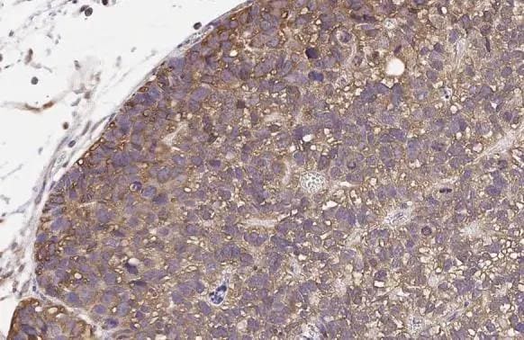 EDNRB/Endothelin R Type B Antibody (HL2832)