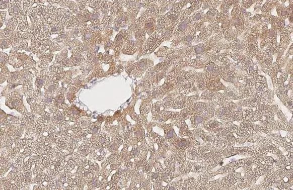 AMFR/gp78 Antibody (HL2865)