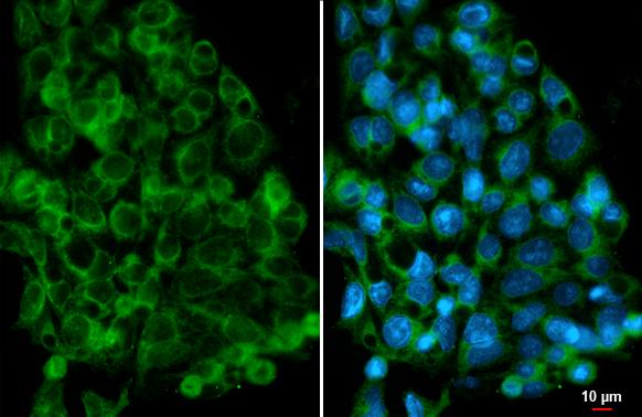 AMFR/gp78 Antibody (HL2866)