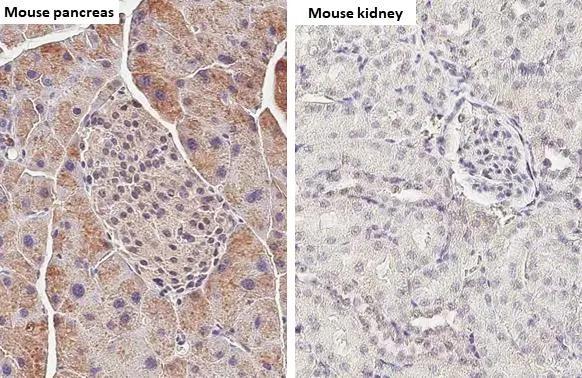 Elastase Antibody (HL2882)